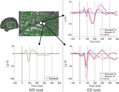 Frontiers | Spatiotemporal Differentiation Of MMN From N1 Adaptation: A ...